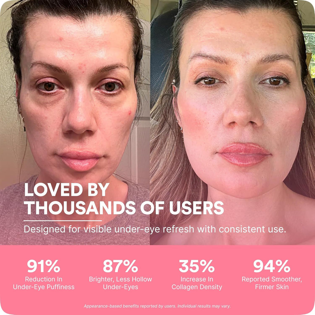 Red Light Therapy for Eyes Bags, Puffiness & Dark Circles